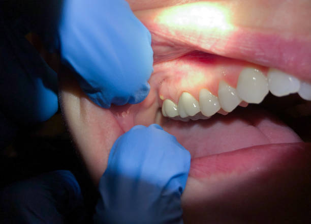 Best Urgent Tooth Repair  in Fort Stockton, TX